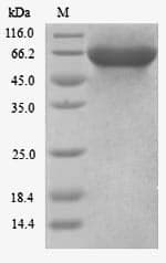 Human KLC3 Protein (Recombinant 6His, N-terminus)