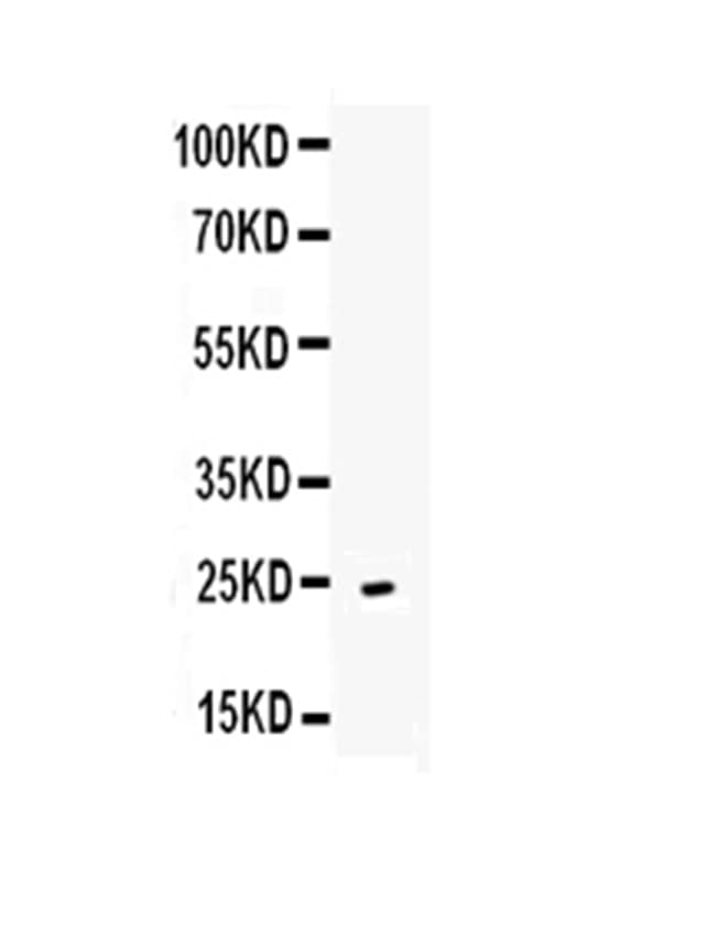 TNFSF4 / OX40L / CD252 Antibody