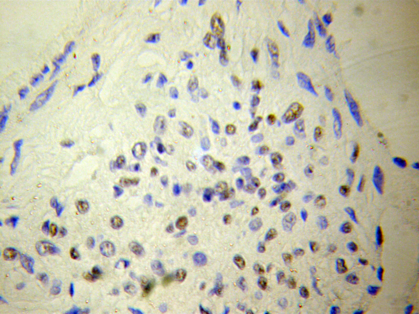 NUDT6 Antibody
