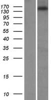 ZNF609 Protein (Over-Expression Lysate Myc-DDK (Flag))