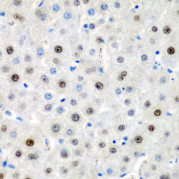 Polyclonal Rabbit anti-Human LMX1B Antibody (IHC, WB)