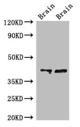Polyclonal Rabbit anti-Human CAMK1 / CAMKI Antibody (IF, WB)