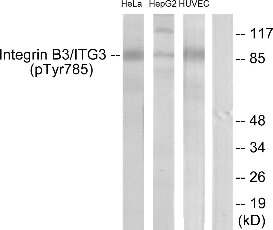 Polyclonal Rabbit anti-Human ITGB3 / Integrin Beta 3 / CD61 Antibody (phospho-Tyr785, WB)