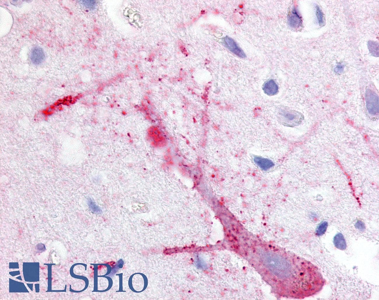 IHC-plus™ Polyclonal Rabbit anti-Human RAIG2 / GPRC5B Antibody (C-Terminus, IHC)