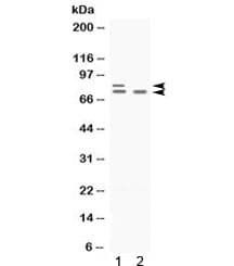 Polyclonal Rabbit anti-Human ZBTB16 / PLZF Antibody (WB)