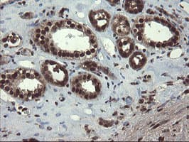 Mannose Phosphate Isomerase Antibody (clone OTI4G7)