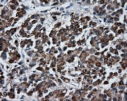HMRF1L / MTRF1L Antibody (clone OTI1E3)