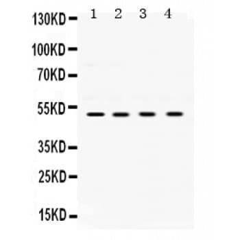 UBE2Q2 Antibody (aa83-123)