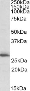 IHC-plus™ CLPP Antibody (aa265-277)