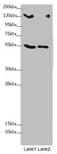Polyclonal Rabbit anti-Human CSPP1 Antibody (IHC, WB)