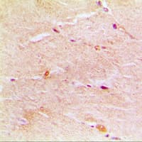 Polyclonal Rabbit anti-Human ACTG1 / Gamma Actin Antibody (C-Terminus, IHC, WB)