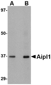 IHC-plus™ Polyclonal Rabbit anti-Human AIPL1 Antibody (IHC, IF, WB)