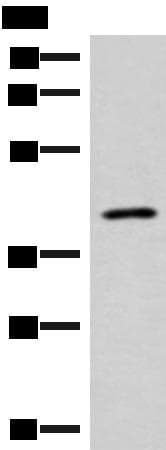 SLC16A7 / MCT2 Antibody