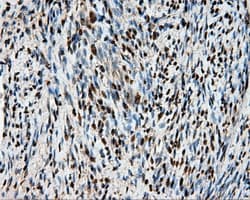 Heat Shock Protein 70 / HSPA1A Antibody (clone OTI3G9)