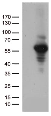 MMP11 Antibody (aa239-488, clone OTI3E10)