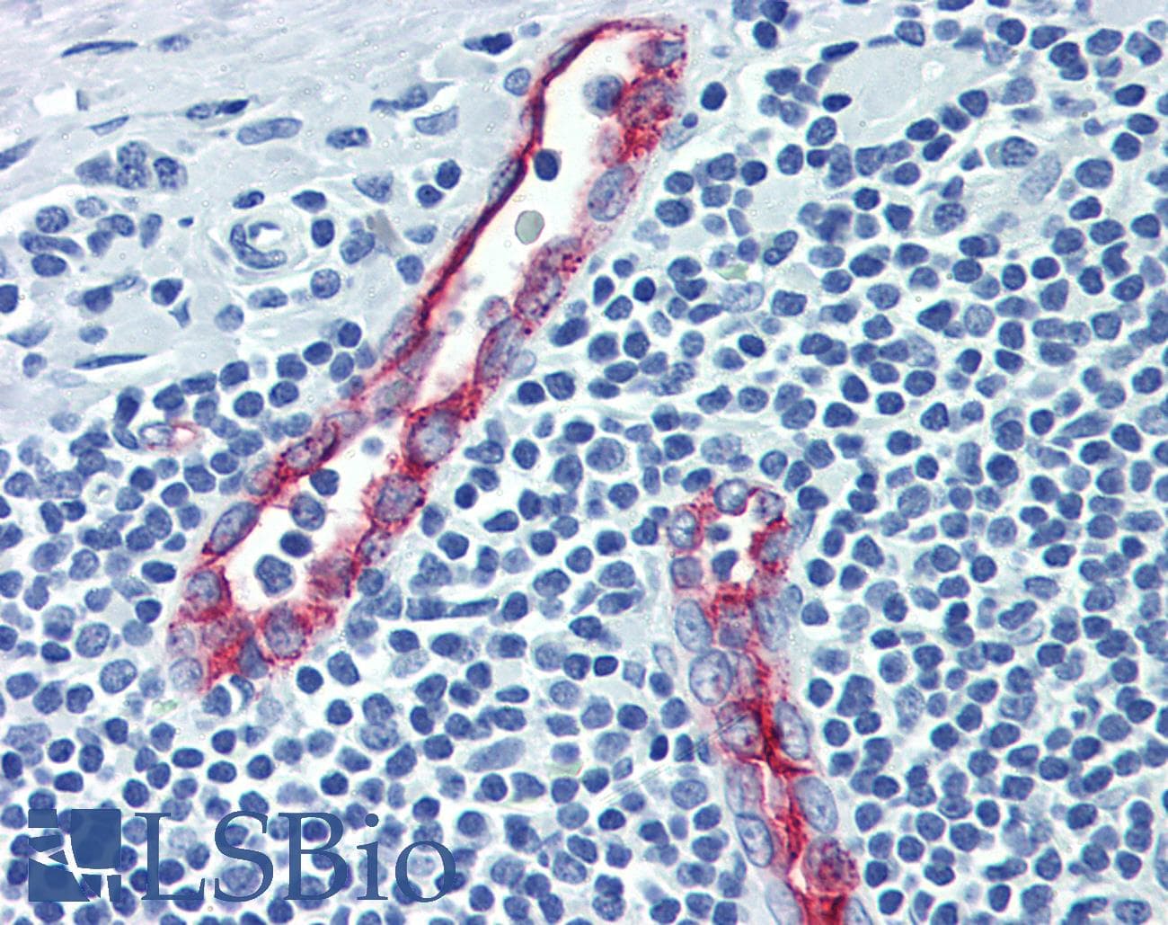 IHC-plus™ SELP / P-Selectin / CD62P Antibody (clone Psel.KO.2.5)