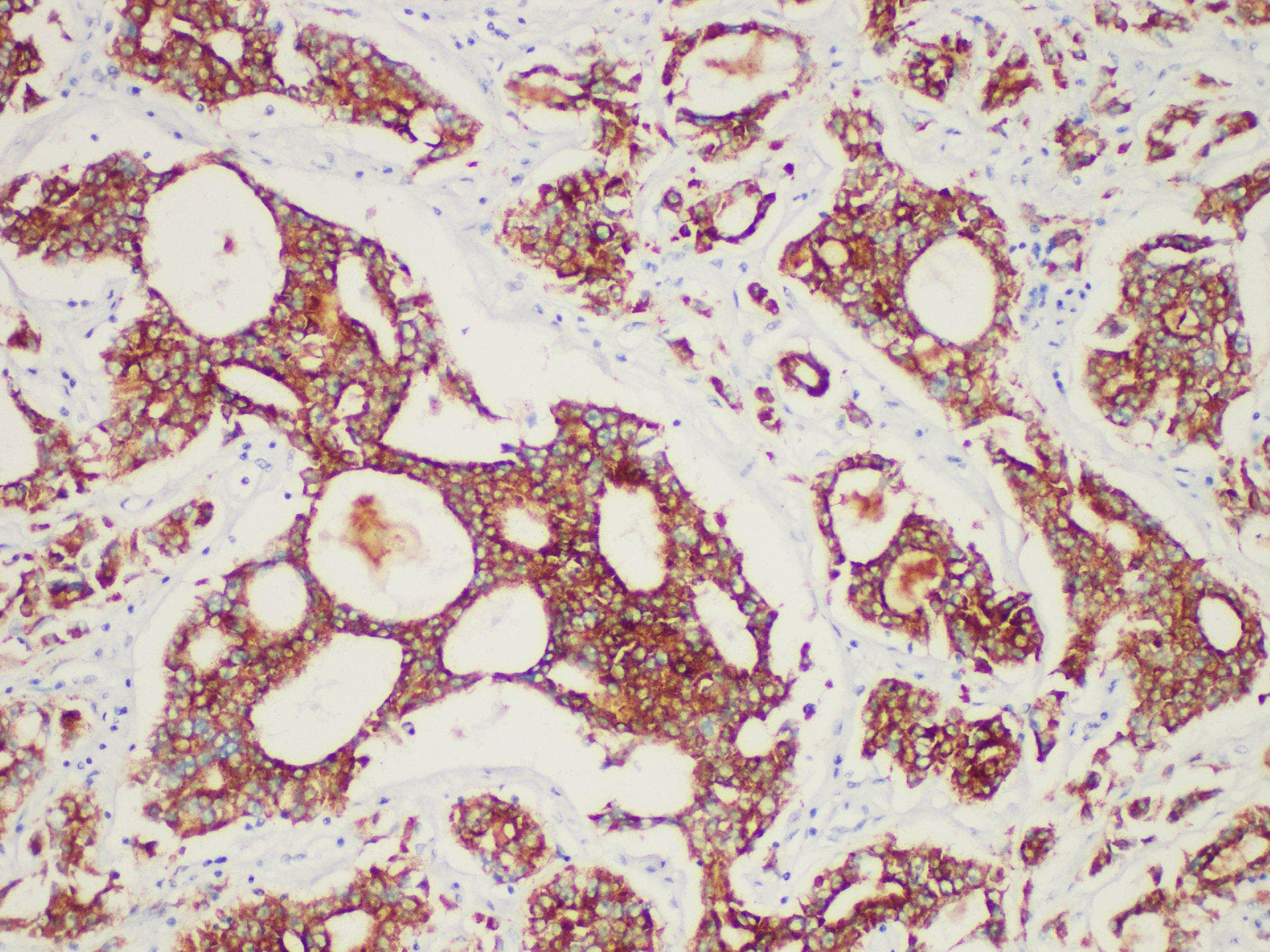 AMACR / P504S Antibody