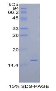 Human AOC1 Protein (Recombinant His)