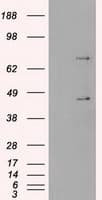 SSB / La Antibody (clone OTI3H9)