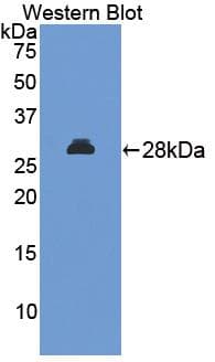 MAPKAPK2 / MAPKAP Kinase 2 Antibody (aa117-337)