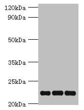 PRDX5 / Peroxiredoxin 5 Antibody (aa53-214)