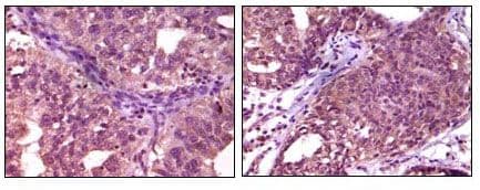 EPHA1 / EPH Receptor A1 Antibody (clone 5D2)