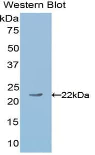 ANGPT1 / Angiopoietin-1 Antibody (aa253-429, FITC)