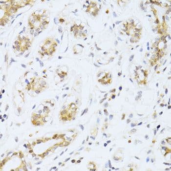 ER81 / ETV1 Antibody