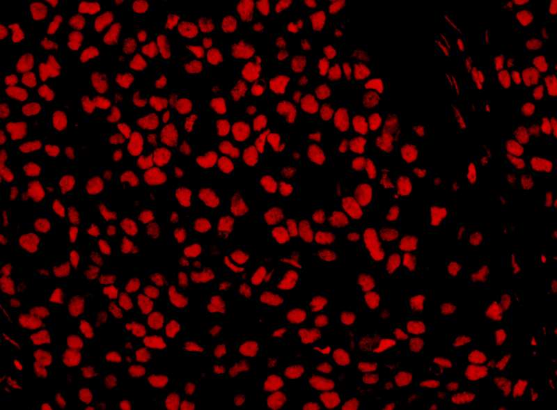 Polyclonal Rabbit anti-Human SET / TAF-I Antibody (aa125-175, IHC, WB)