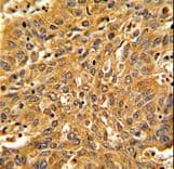 Polyclonal Rabbit anti-Human FSCN1 / Fascin Antibody (aa322-350, IHC, WB)