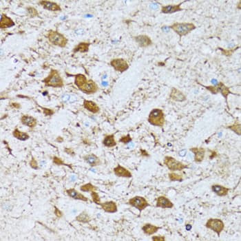 Polyclonal Rabbit anti-Human NOL3 / ARC Antibody (IHC, IF, WB)