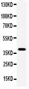 APCS / Serum Amyloid P / SAP Antibody (aa21-228)