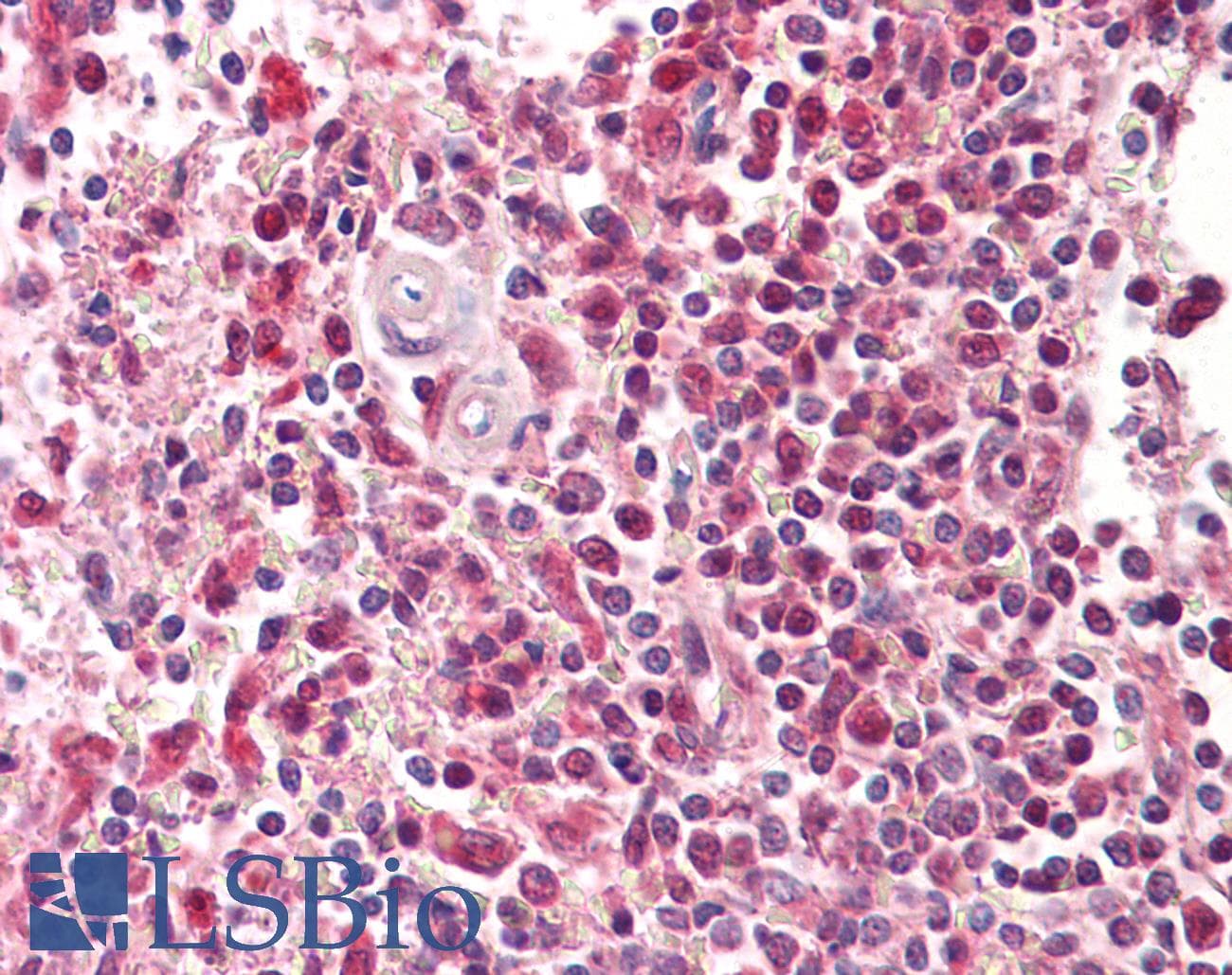 IHC-plus™ Polyclonal Rabbit anti-Human HNRNPC / HNRNP C Antibody (aa231-280, IHC, WB)