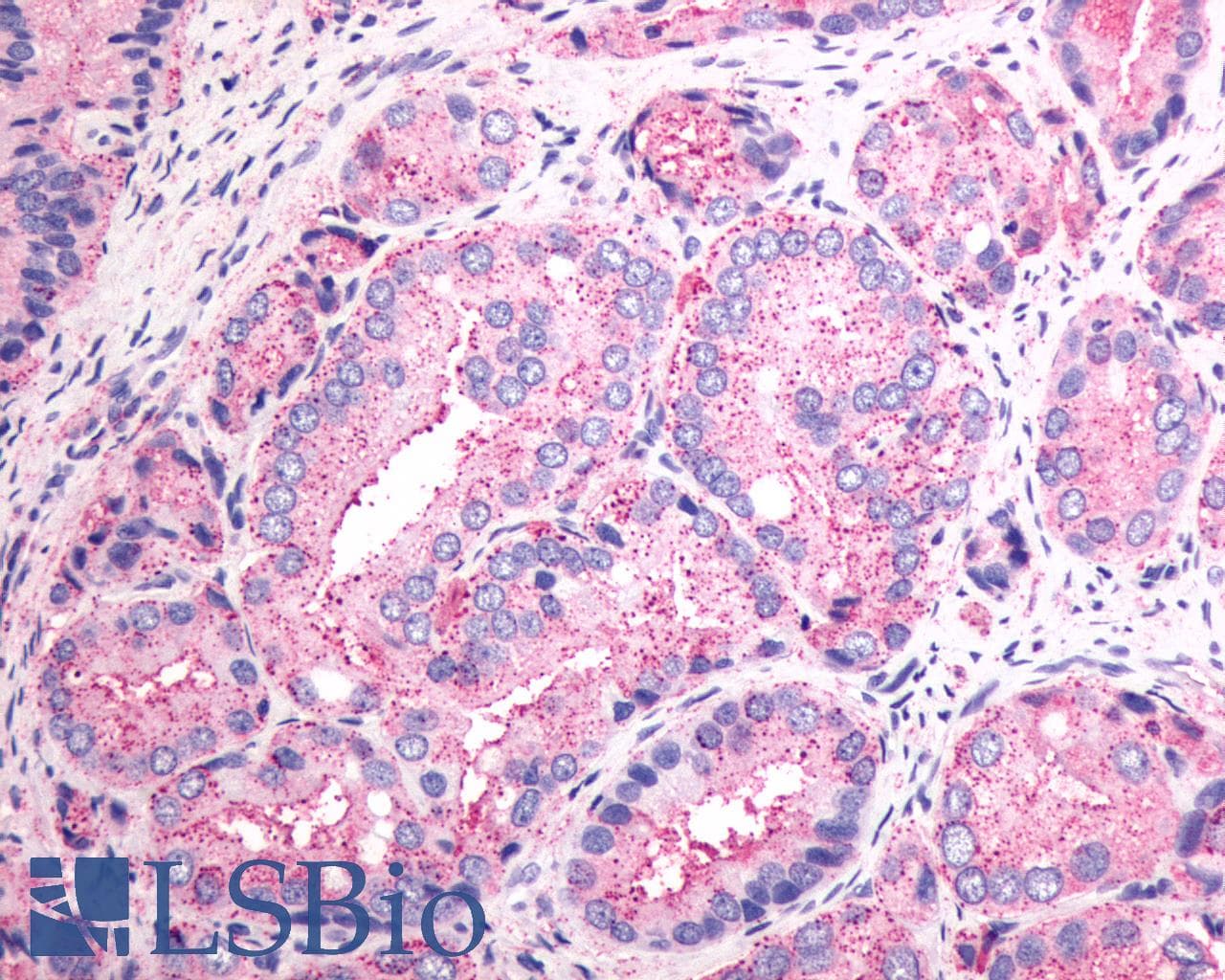 PathPlus™ SSTR1 Antibody (N-Terminus)