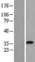 TRNAU1AP / TRSPAP1 Protein (Over-Expression Lysate Myc-DDK (Flag))