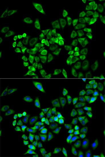 IHC-plus™ AOC3 / VAP-1 Antibody