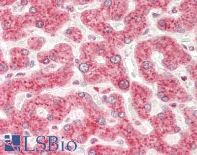 IHC-plus™ SLC25A37 / Mitoferrin Antibody (aa309-338)