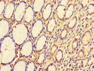 CDS1 Antibody