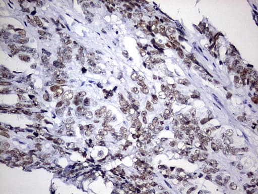EZH2 Antibody (aa182-431, clone OTI2B10)