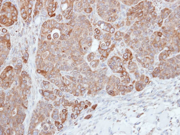 HPS3 Antibody (aa942-1004)
