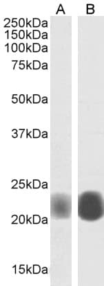 PathPlus™ Polyclonal Goat anti-Human CAV1 / Caveolin 1 Antibody (aa73-84, IHC, IF, WB)