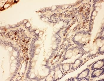 Polyclonal Rabbit anti-Mouse MMP7 / Matrilysin Antibody (aa95-264, IHC, WB)