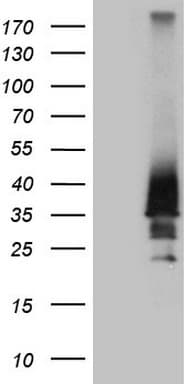 HOXD4 Antibody (clone OTI1E9)