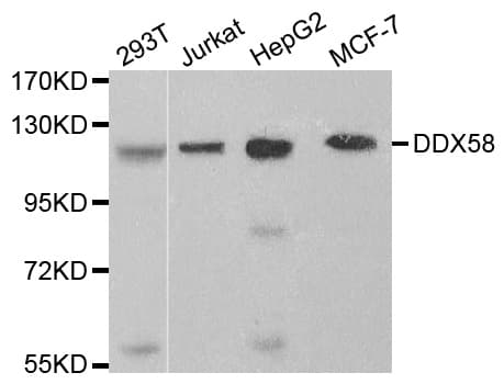 Polyclonal Rabbit anti-Human DDX58 / RIG-1 / RIG-I Antibody (IHC, IF, WB)