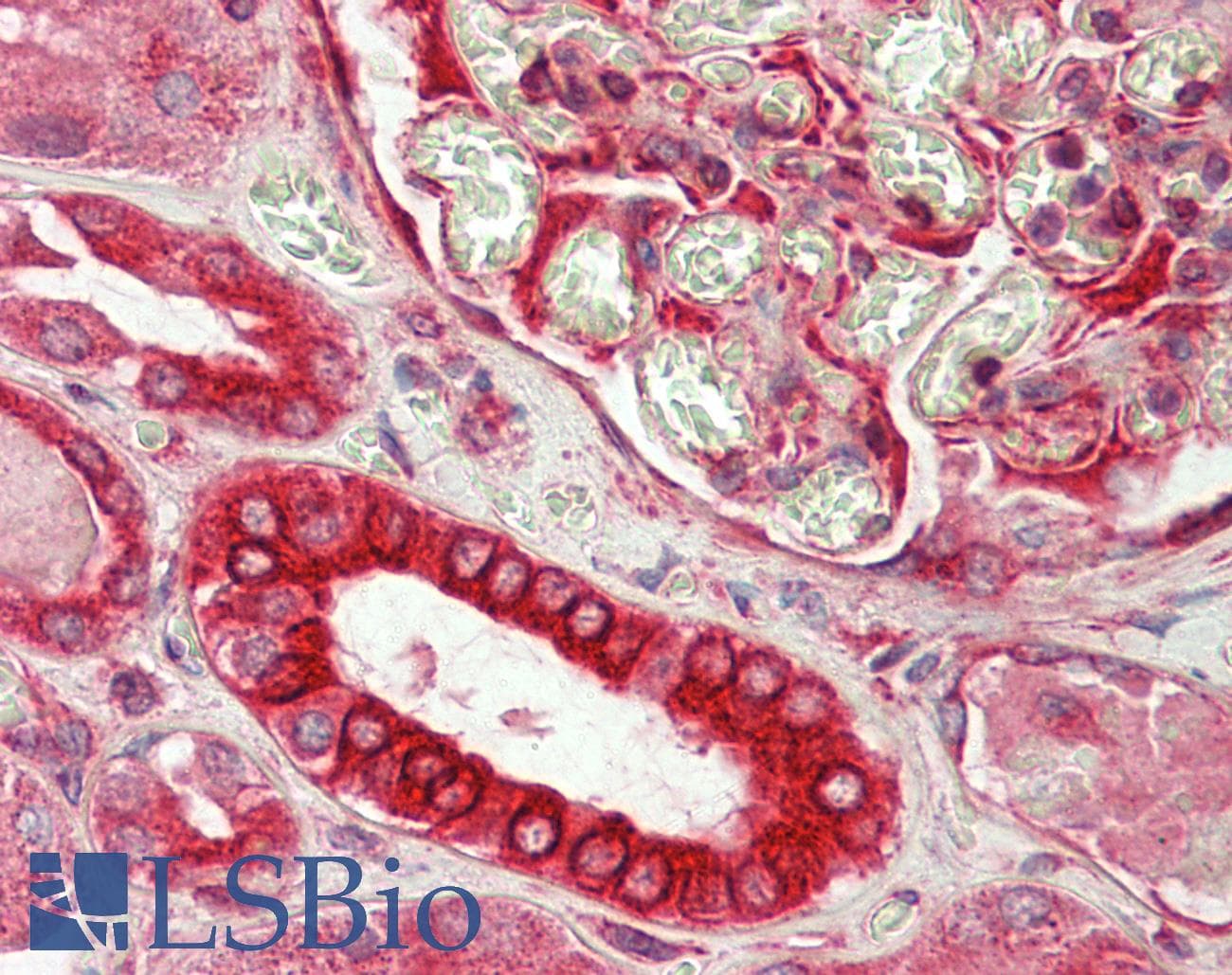 IHC-plus™ DVL1 / DVL / Dishevelled Antibody (aa20-32)