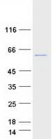 Human CYP21A2 Protein (Recombinant Myc-DDK (Flag))