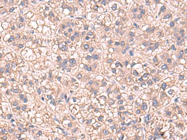 SARS / Serine-tRNA Ligase Antibody