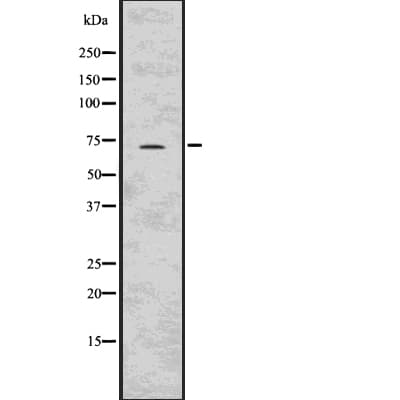 BIRC3 / cIAP2 Antibody