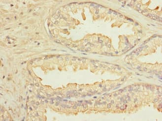 Polyclonal Rabbit anti-Human KLHL13 Antibody (IHC, WB)