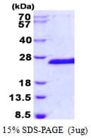 Human SIAH1 Protein (Recombinant His)